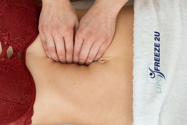 diastasis recti treatment Walton-on-Thames