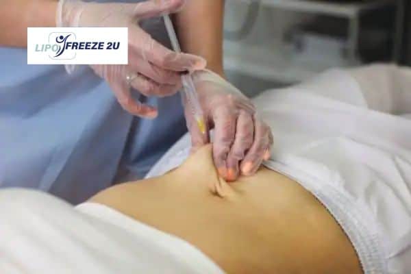 Fat Dissolving Injections Walton-on-Thames & Weight loss medication