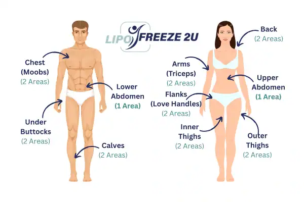 Areas you can have fat freezing treatment Walton-on-Thames