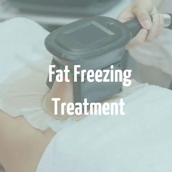 fat freezing treatment Walton-on-Thames