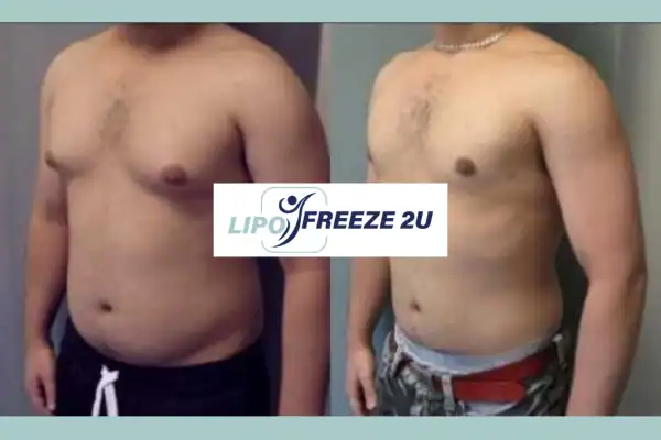 How Long Does It Take to See Results Walton-on-Thames?