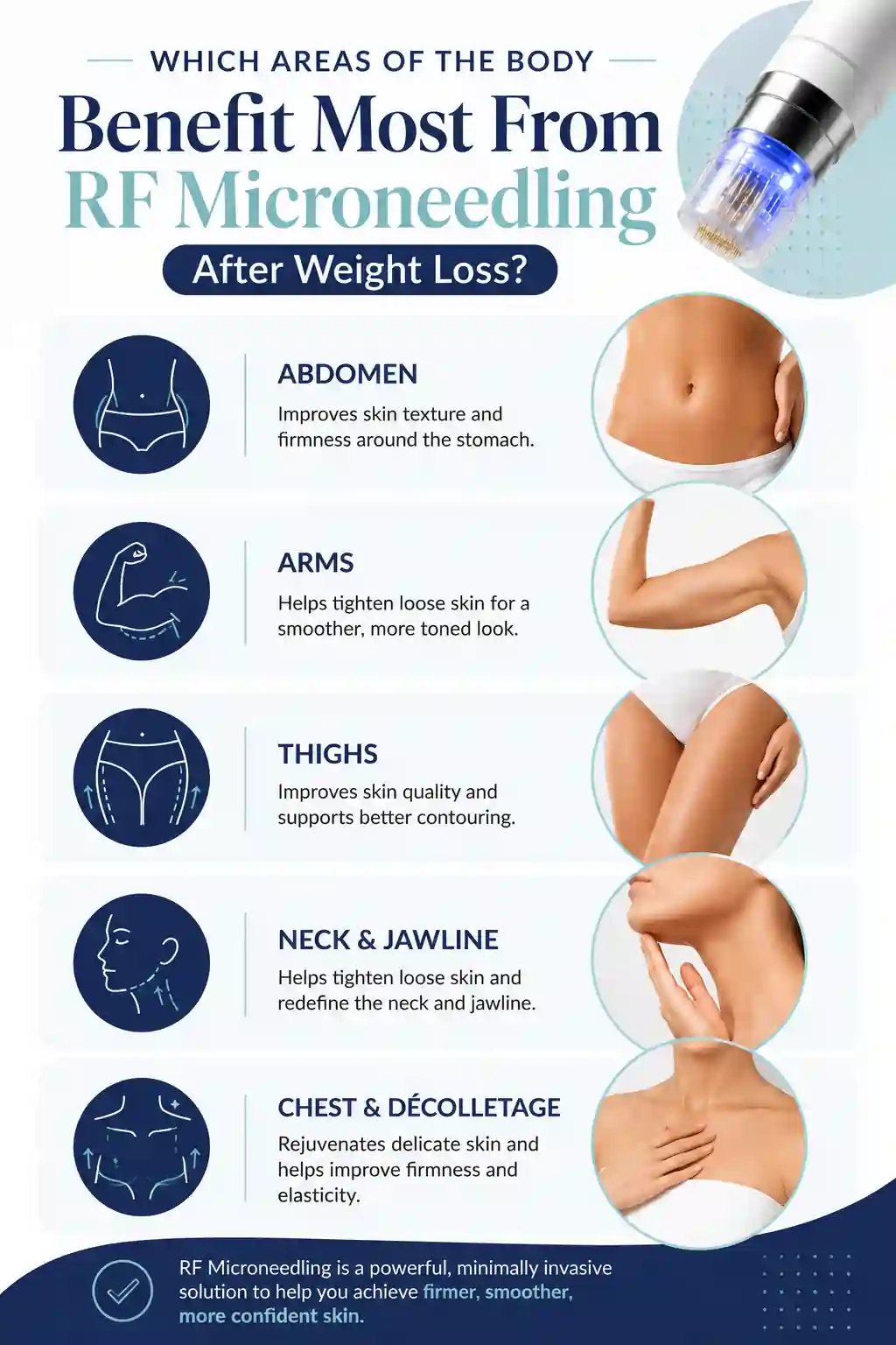 Which Areas of the Body Benefit Most From RF Microneedling After Weight Loss Walton-on-Thames